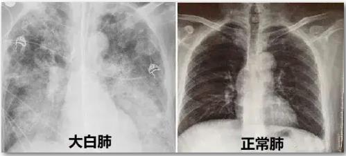 景东彝族自治县人民医院
