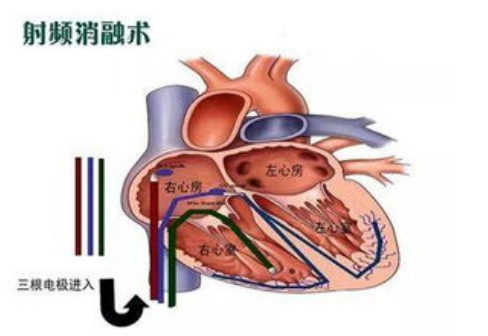 微信图片_20230703165802.png